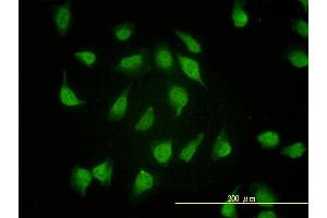 Immunofluorescence of monoclonal antibody to PSMA4 on HeLa cell.