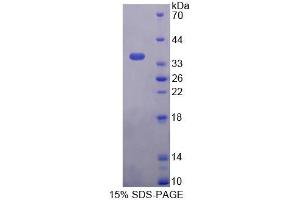 SDS-PAGE (SDS) image for Pyridoxamine 5'-Phosphate Oxidase (PNPO) (AA 1-261) protein (His tag) (ABIN6238809) (PNPO Protein (AA 1-261) (His tag))
