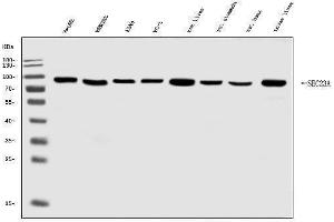 Western blot analysis of SEC23A using anti-SEC23A antibody (ABIN7600428).