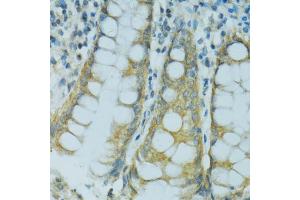 Immunohistochemistry of paraffin-embedded human colon using CYP2B6 antibody (ABIN5997556) at dilution of 1/100 (40x lens). (CYP2B6 anticorps)