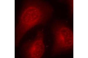 Immunofluorescence (IF) image for anti-Histone Deacetylase 8 (HDAC8) (pSer39) antibody (ABIN1870227) (HDAC8 anticorps  (pSer39))