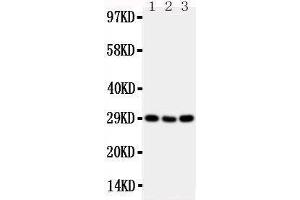 Anti-CD134/OX40 antibody,  Western blotting Lane 1: Mouse Brain Tissue Lysate Lane 2: Mouse Spleen Tissue Lysate Lane 3: Mouse Liver Tissue Lysate (TNFRSF4 anticorps  (N-Term))