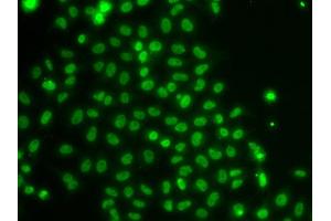 Immunofluorescence analysis of U20S cell using TOX antibody. (TOX anticorps)