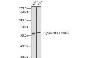 Western blot analysis of extracts of various cell lines, using Cytokeratin 5 (KRT5) antibody (ABIN3016404, ABIN3016405, ABIN3016406 and ABIN6219743) at 1:1000 dilution.