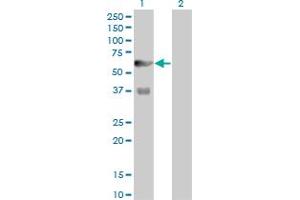 Western Blot analysis of PFKFB3 expression in transfected 293T cell line by PFKFB3 monoclonal antibody (M08), clone 3F3. (PFKFB3 anticorps  (AA 412-520))