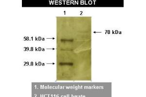 Western Blotting (WB) image for anti-RYK Receptor-Like Tyrosine Kinase (RYK) antibody (ABIN264516) (RYK anticorps)