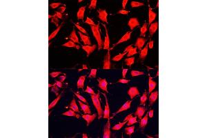 Immunofluorescence analysis of NIH-3T3 cells using  Polyclonal Antibody (ABIN6129956, ABIN6136944, ABIN6136945 and ABIN6221849) at dilution of 1:100 (40x lens).