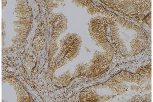 ABIN6278110 at 1/100 staining Mouse colon tissue by IHC-P. (DAP Kinase 1 anticorps  (Internal Region))