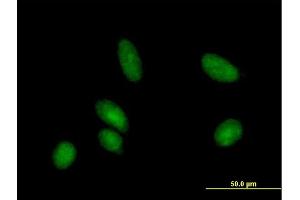 Immunofluorescence of purified MaxPab antibody to CDA on HeLa cell. (CDA anticorps  (AA 1-146))