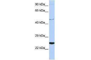 WB Suggested Anti-CRLF1 Antibody Titration:  0. (CRLF1 anticorps  (Middle Region))