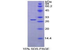 SDS-PAGE analysis of Mouse PTPRS Protein. (PTPRS Protéine)