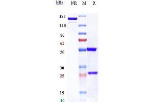 Anti-TNFRSF8 / CD30 Reference Antibody (brentuximab) on SDS-PAGE under reducing (R) condition. (Recombinant TNFRSF8 (Brentuximab Biosimilar) anticorps)