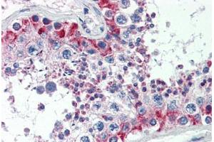 Human Testis (formalin-fixed, paraffin-embedded) stained with MAS1 antibody ABIN462250 followed by biotinylated goat anti-rabbit IgG secondary antibody ABIN481713, alkaline phosphatase-streptavidin and chromogen.