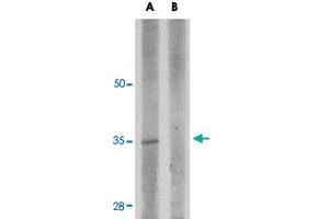 Western blot analysis of RWDD3 in rat kidney tissue lysate with RWDD3 polyclonal antibody  at 1 ug/mL in (A) the absence and (B) the presence of blocking peptide. (RWDD3 anticorps  (C-Term))