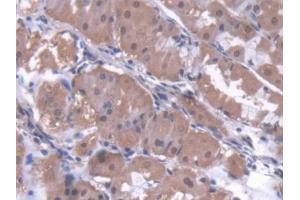 Detection of ZNF10 in Human Stomach Tissue using Polyclonal Antibody to Zinc Finger Protein 10 (ZNF10)