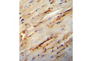COL5A1 antibody immunohistochemistry analysis in formalin fixed and paraffin embedded mouse heart tissue followed by peroxidase conjugation of the secondary antibody and DAB staining.