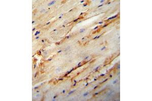 COL5A1 antibody immunohistochemistry analysis in formalin fixed and paraffin embedded mouse heart tissue followed by peroxidase conjugation of the secondary antibody and DAB staining. (COL5A1 anticorps  (N-Term))