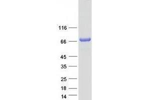 Validation with Western Blot