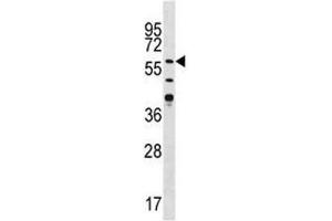 Western blot analysis of CAMK2G antibody in Jurkat lysate (CAMKII gamma anticorps  (AA 309-338))