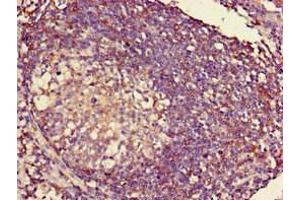Immunohistochemistry of paraffin-embedded human lymph node tissue using ABIN7155626 at dilution of 1:100 (HLA-C anticorps  (AA 25-308) (Biotin))