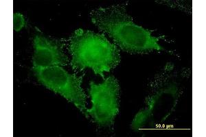 Immunofluorescence of monoclonal antibody to STX1A on HeLa cell.