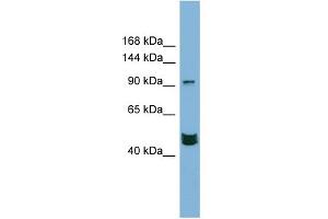 WB Suggested Anti-MAML3 Antibody Titration:  0. (MAML3 anticorps  (Middle Region))