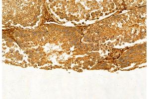 ABIN6265271 and ABIN6272907 at 1/100 staining Rat testis tissue by IHC-P. (SQLE anticorps  (C-Term))