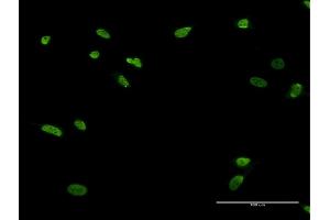 Immunofluorescence of monoclonal antibody to ZNF287 on HeLa cell.