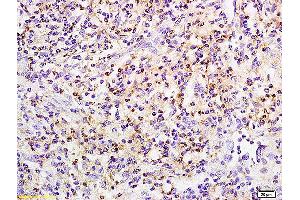 Formalin-fixed and paraffin embedded rat small intestine labeled with Anti phospho-PRKCB(Ser642) Polyclonal Antibody, Unconjugated (ABIN711461) at 1:200 followed by conjugation to the secondary antibody and DAB staining (Pkc beta 1 anticorps  (pSer642))