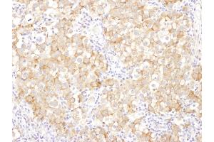 anti-Drebrin 1 (DBN1) (AA 599-649) antibody