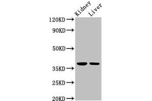 Western Blot Positive WB detected in: Rat kidney tissue, Mouse liver tissue All lanes: TAF8 antibody at 2.