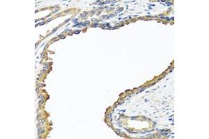 Immunohistochemistry of paraffin-embedded human prostate using NYX antibody. (Nyctalopin anticorps  (AA 282-481))