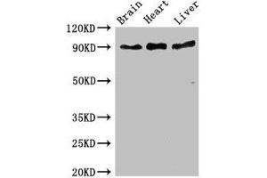 Western Blot Positive WB detected in: Mouse brain tissue, Rat heart tissue, Rat liver tissue All lanes: RPS6KA5 antibody at 3 μg/mL Secondary Goat polyclonal to rabbit IgG at 1/50000 dilution Predicted band size: 90, 62, 82 kDa Observed band size: 90 kDa (MSK1 anticorps  (AA 224-367))