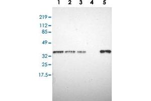 Western blot analysis of Lane 1: RT-4, Lane 2: U-251 MG, Lane 3: A-431, Lane 4: Liver, Lane 5: Tonsil with STX7 polyclonal antibody  at 1:250-1:500 dilution. (Syntaxin 7 anticorps)