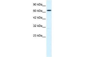 WB Suggested Anti-KCNN2 Antibody Titration:  1.