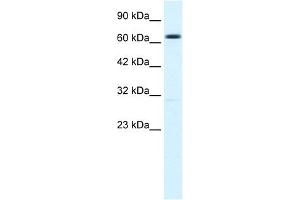 WB Suggested Anti-KCNN2 Antibody Titration:  1. (KCNN2 anticorps  (C-Term))