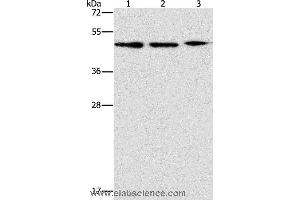 Western blot analysis of PC3, Jurkat and Raji cell, using APOBEC3G Polyclonal Antibody at dilution of 1:240 (APOBEC3G anticorps)