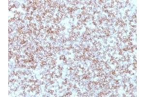 Formalin-fixed, paraffin-embedded human tonsil stained with HLA-DP / HLA-DR antibody (Bra-14). (HLA-DP/DR anticorps)