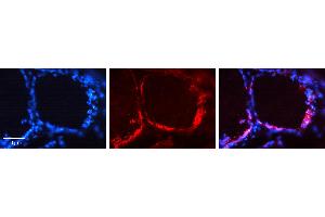 Rabbit Anti-CDH1 Antibody   Formalin Fixed Paraffin Embedded Tissue: Human Thyroid Gland Tissue Observed Staining: Plasma membrane Primary Antibody Concentration: 1:100 Other Working Concentrations: N/A Secondary Antibody: Donkey anti-Rabbit-Cy3 Secondary Antibody Concentration: 1:200 Magnification: 20X Exposure Time: 0.