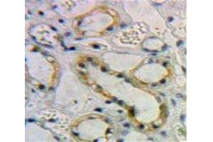 Used in DAB staining on fromalin fixed paraffin-embedded Kidney tissue (Activin A Receptor Type IB/ALK-4 anticorps  (AA 24-126))