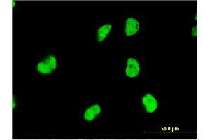 Immunofluorescence of monoclonal antibody to DAZAP1 on HeLa cell. (DAZAP1 anticorps  (AA 308-407))