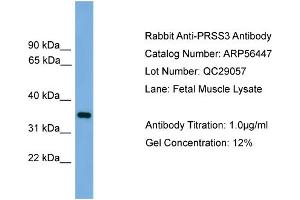 WB Suggested Anti-PRSS3  Antibody Titration: 0. (PRSS3 anticorps  (N-Term))