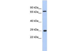WB Suggested Anti-AKTIP Antibody Titration: 0. (AKTIP anticorps  (Middle Region))