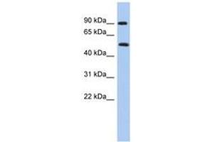 Image no. 1 for anti-Protein Arginine Methyltransferase 7 (PRMT7) (N-Term) antibody (ABIN6742956) (PRMT7 anticorps  (N-Term))