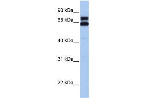 WB Suggested Anti-HSPD1 Antibody Titration:  0. (HSPD1 anticorps  (C-Term))