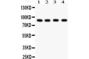 Western Blotting (WB) image for anti-Furin (Paired Basic Amino Acid Cleaving Enzyme) (FURIN) (AA 591-794) antibody (ABIN3042409) (FURIN anticorps  (AA 591-794))