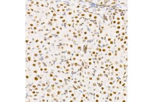 Immunohistochemistry of paraffin-embedded rat ovary using TCE Rabbit mAb (ABIN7270877) at dilution of 1:25 (40x lens). (TCEA1 anticorps)