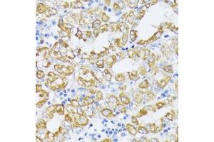 Immunohistochemistry of paraffin-embedded human stomach using SLC30 antibody (2532) at dilution of 1:100 (40x lens). (SLC30A1 anticorps  (AA 250-350))