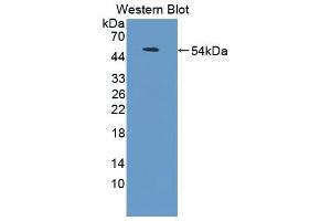Western blot analysis of the recombinant protein. (CD58 anticorps  (AA 1-214))