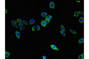 Immunofluorescent analysis of HepG2 cells using ABIN7170581 at dilution of 1:100 and Alexa Fluor 488-congugated AffiniPure Goat Anti-Rabbit IgG(H+L)